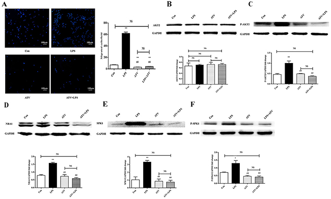 Atorvastatin (ATV) inhibits LPS-induced macrophage migration and protein expression of AKT2, P-AKT2, NBA1, SPK1, and P-SPK1 in macrophages.