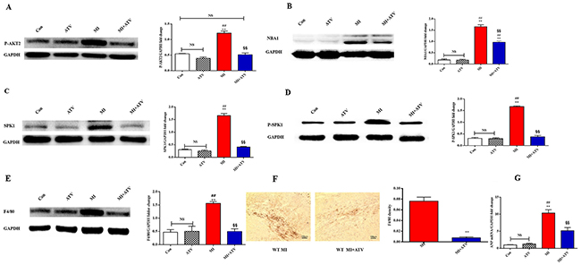 ATV ameliorated cardiac remodeling by inhibiting P-AKT2/NBA1/SPK1(P-SPK1) related macrophages recruitment in the infarction area after MI for 7 days.