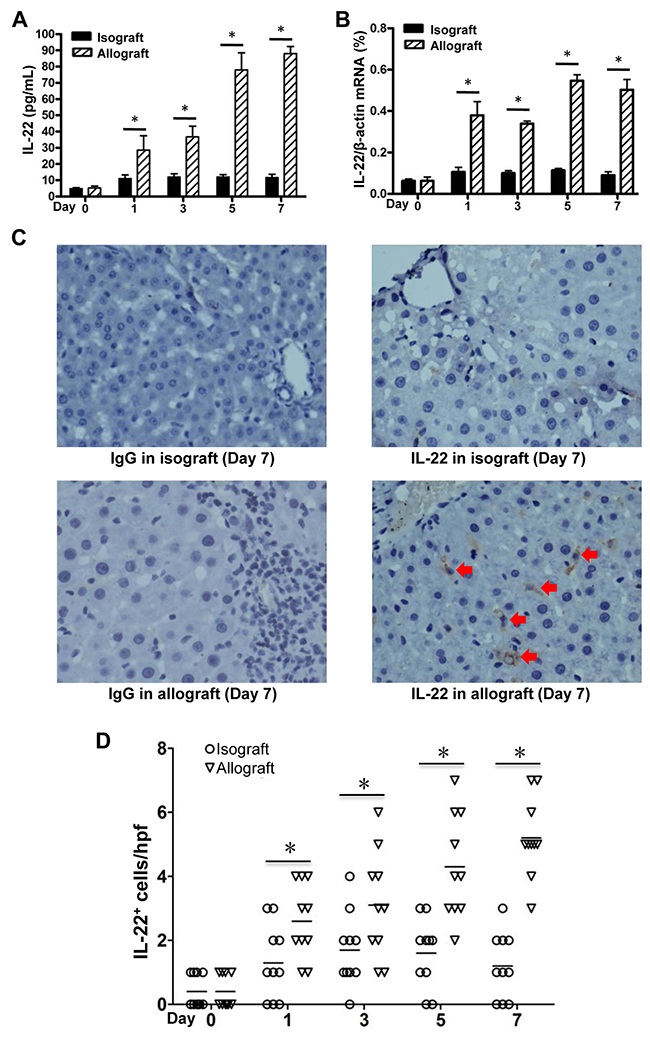 IL-22 expression in allogeneic and isogenic liver transplant tissues.