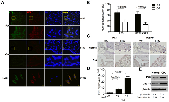 Increased p73 levels with co-localized iASPP expression in the rheumatoid joint.