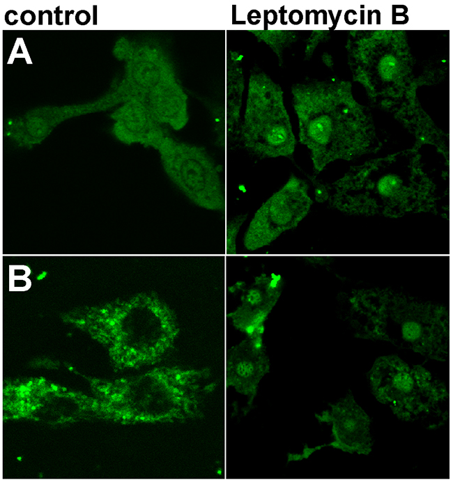 Nuclear localization of WT and L190G FBP2 in control conditions and after the nuclear export blockade with Leptomycin B.