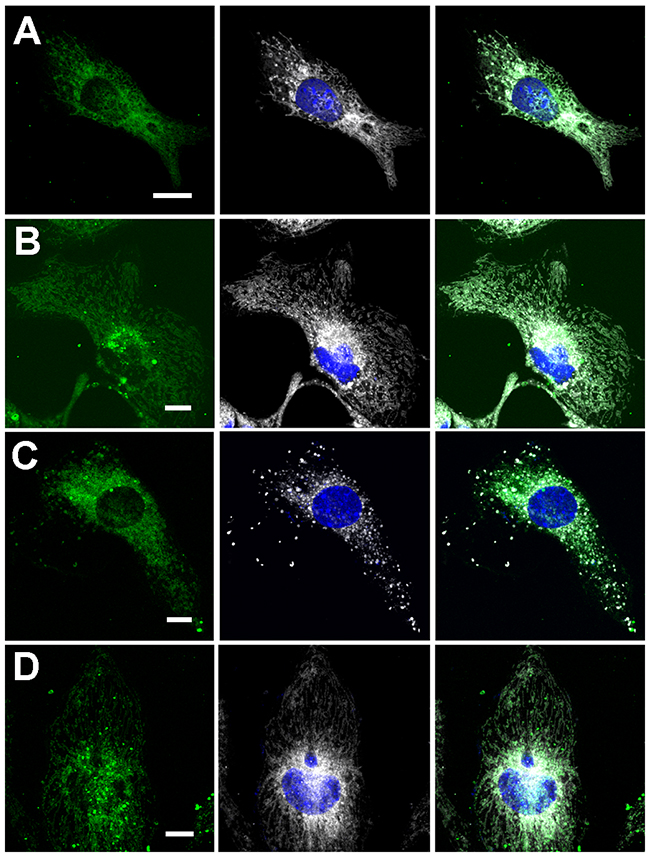 Co-localization of FBP2 forms (green) with mitochondria (gray) in HL-1 cardiomyocytes.