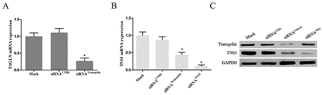 Transgelin upregulates TNS1 expression in CRC cells.