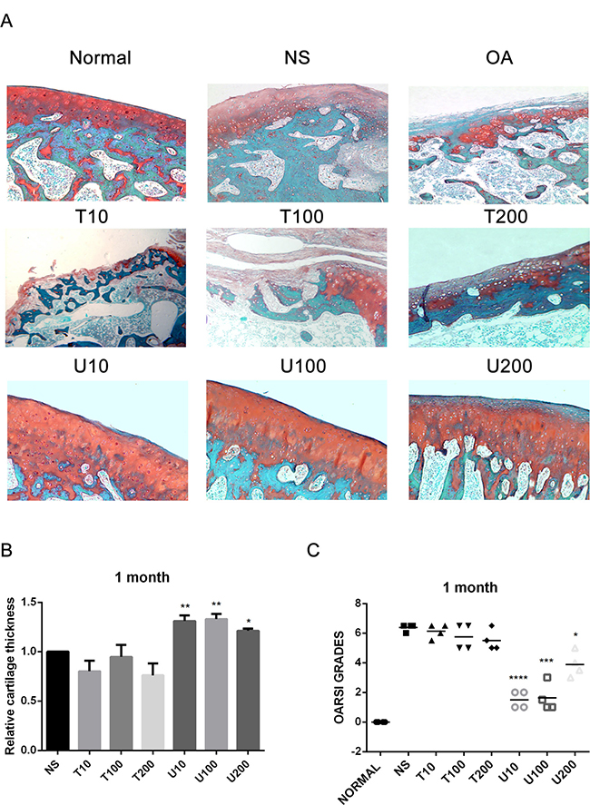 Histopathological evaluation of OA in a rat OA model treated with different inhibitors of PLC&#x03B3;1 and Akt for 1 month.