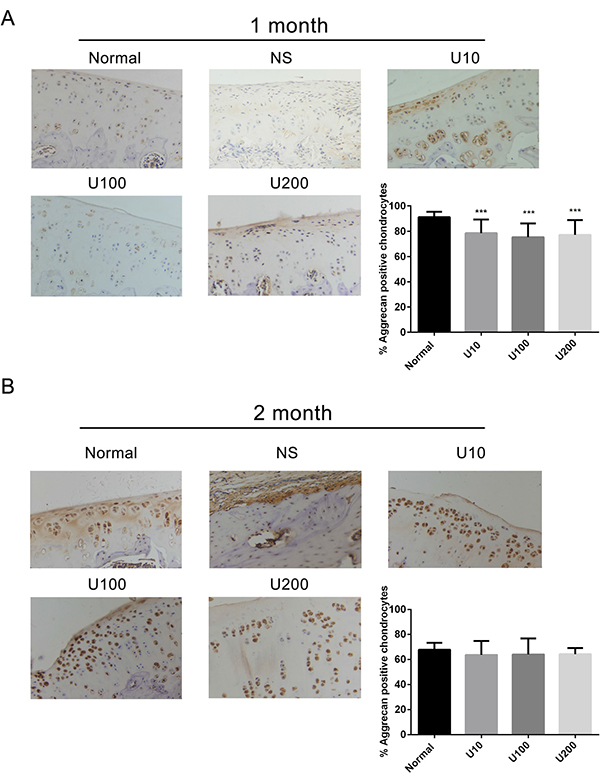 Effect of PLC&#x03B3;1 inhibitor on Aggrecan expression in a rat OA model.