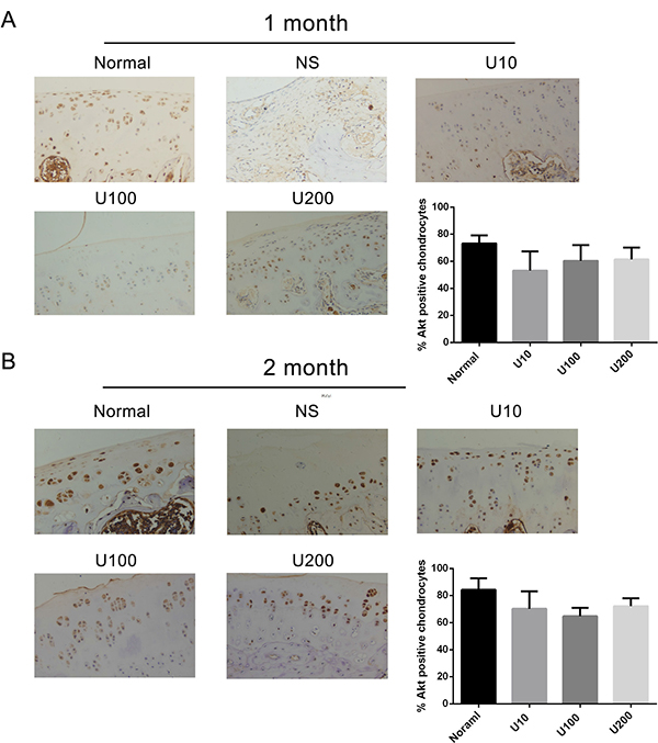 Effect of PLC&#x03B3;1 inhibitor on Akt expression in a rat OA model.