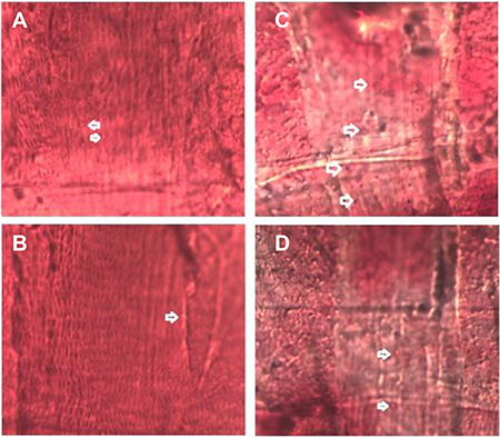 Oil Red O staining of cardiac muscle in five-week old flies.
