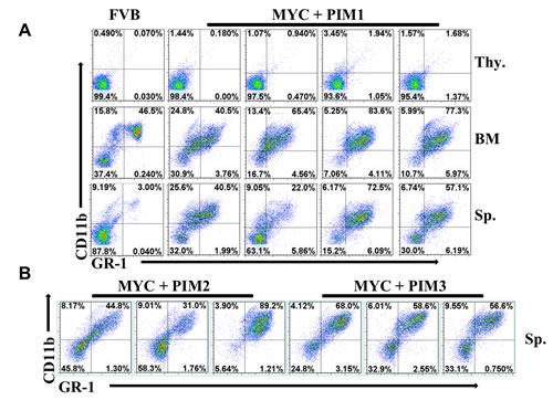 Expression of MYC and PIM kinases drives myeloid leukemia.