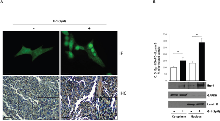 G-1 induces nuclear translocation of Egr-1 in H295R cells.