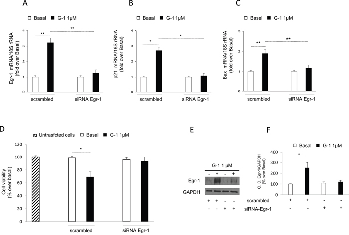 Egr-1 gene silencing reversed G-1-induced effects on H295R.