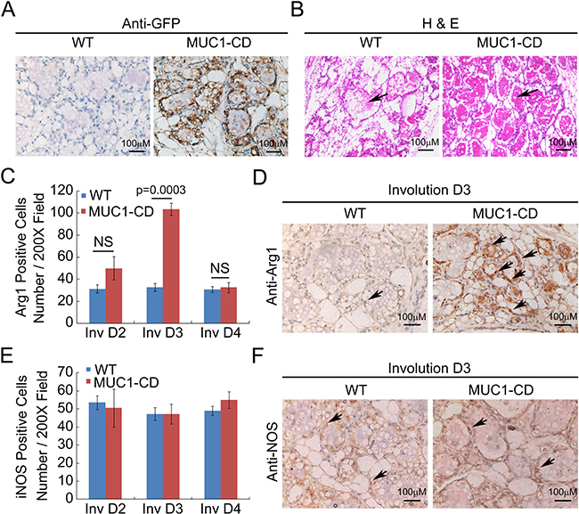 Overexpression of MUC1-CD delays postpartum mammary gland involution and induces M2 type macrophage influx.