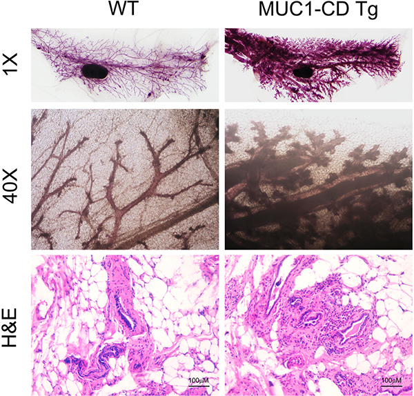 Overexpression of MUC1-CD induces hyperplasia and tumorigenesis in multiparous mammary glands.