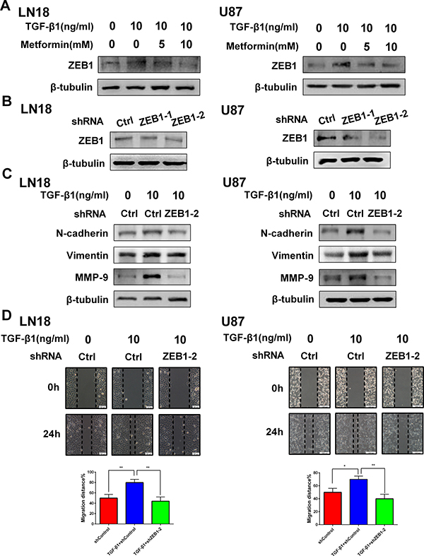 ZEB1 is associated with the inhibitory effect of metformin on TGF-&#x03B2;1 induced EMT-like process in GBM cells.