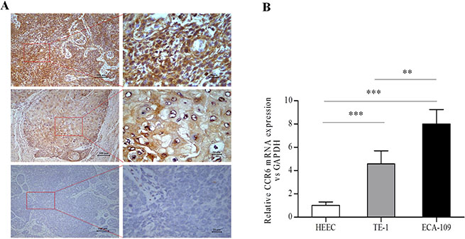 Analysis of CCR6 expression in esophageal tissues and CCR6 mRNA in esophageal cell lines.
