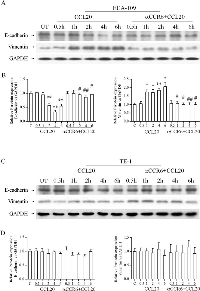 Effects of CCR6-CCL20 interactions on EMT of ESCC cell on protein level.