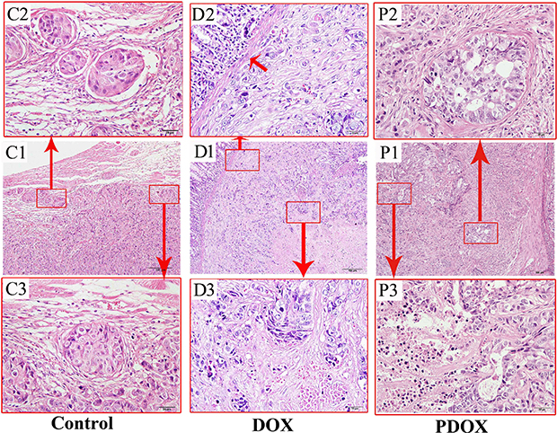 Routine histopathological features of the MGC-803 gastric cancer of different treatment groups.