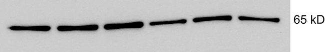 Immunoblot of FZD10 from lysates of Huh7 cells transduced with miRZip 548p (lanes 1&#x2013;3) or scramble sequence (lanes 4&#x2013;6) showing overexpression of FZD10 in cells transduced with miRZip 548p.