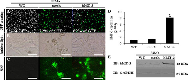 Comparison of WT, mock and hMT-3 neuroblastoma (SiMa) cells.