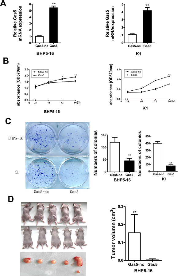 Gas5 represses proliferation of PTC cells in vitro and in vivo.