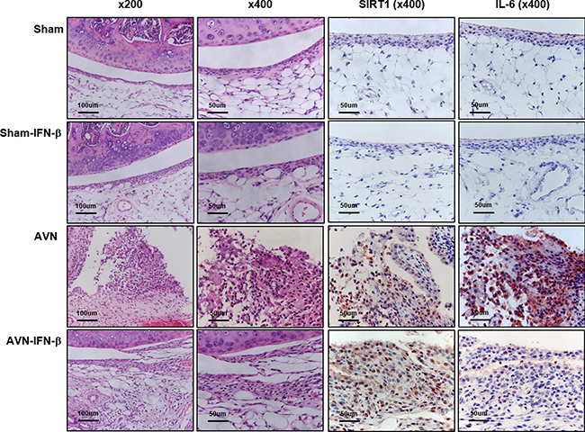 Histologic features of synovium.