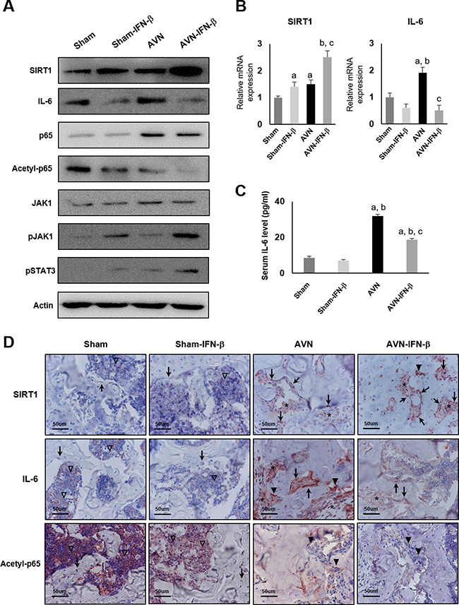 Western blot analysis, real-time RT-PCR, and immunohistochemical staining of sham and AVN groups four weeks after IFN-&#x03B2; treatment.