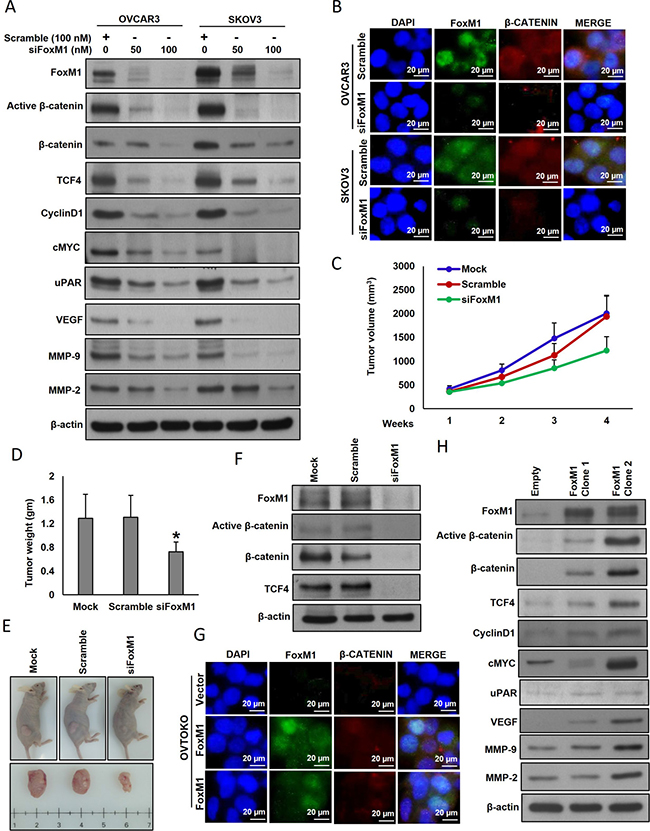 Effect of FoxM1 silencing and forced expression in EOC cell lines.