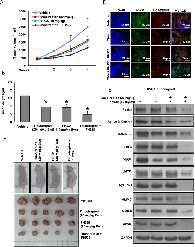 Thiostrepton and FH535 synergistically inhibits EOC tumor growth in vivo.