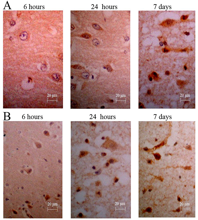 Immunohistochemistry for NGF of canines&#x2019; brain.