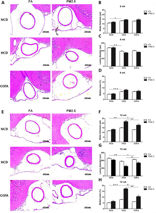 Representative photomicrographs of hematoxylin-eosin staining of middle cerebral artery sections.