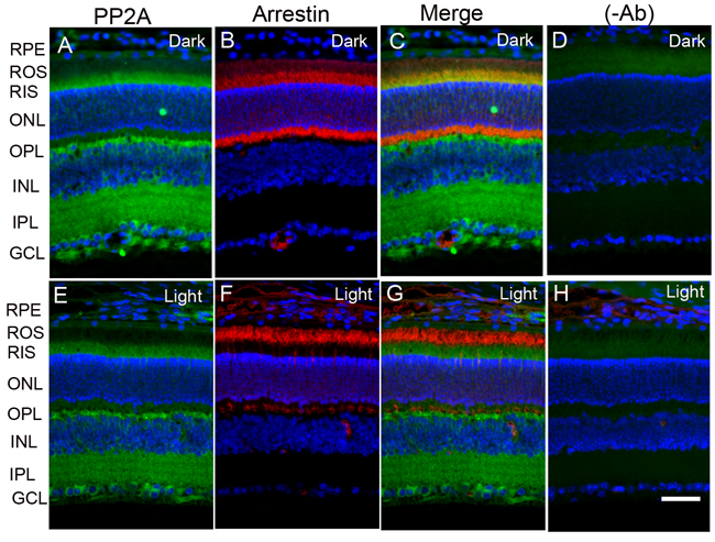 Immunofluorescence analysis of PP2A in mouse retina.