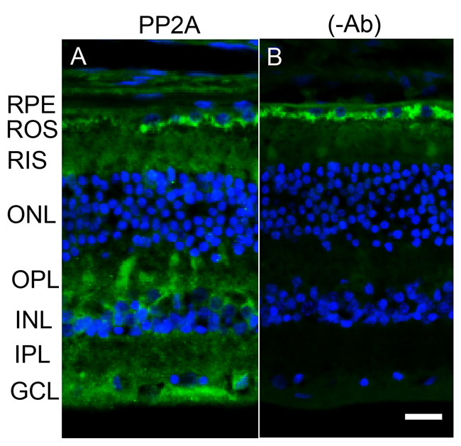 Immunofluorescence analysis of PP2A in postmortem human eye tissue.