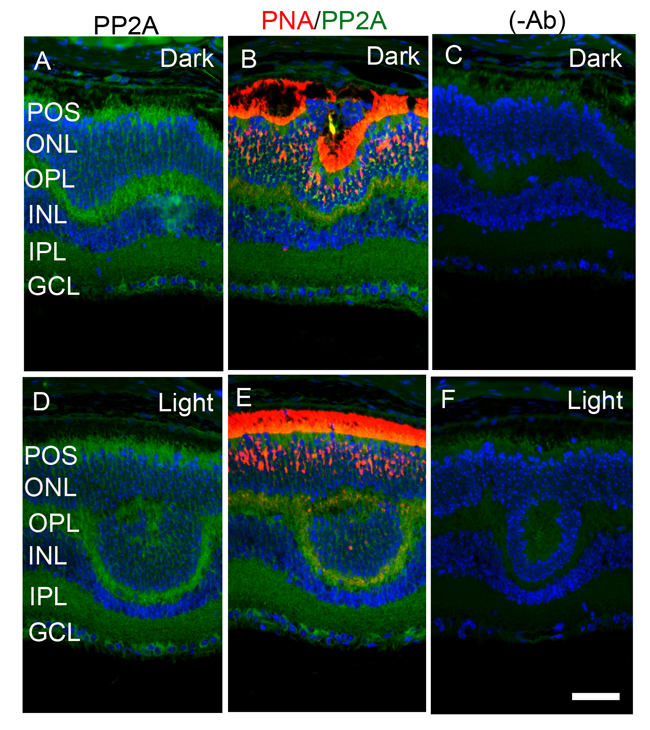 Immunofluorescence analysis of PP2A in cone-dominant