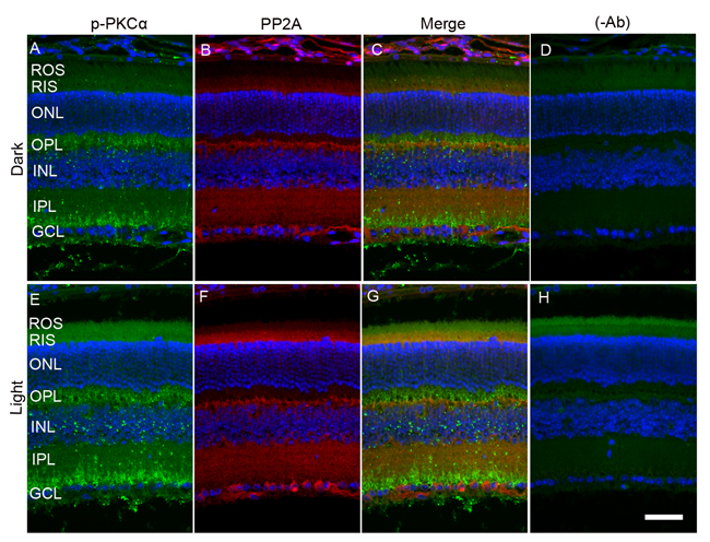 Immunofluorescence analysis of p-PKC&#x3b1; and PP2A in dark- and light-adapted mouse retina.