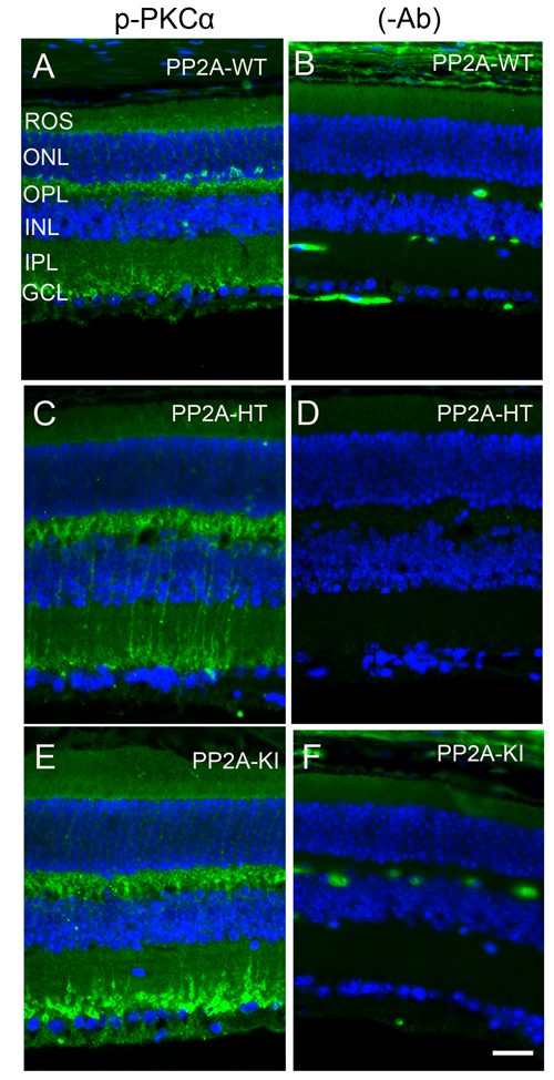 Increased PKC&#x3b1; phosphorylation in PP2A-KI mice.