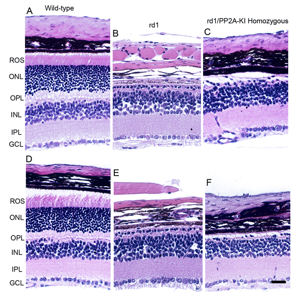 Effect of PP2A on PDE6&#x3b2;-mediated retinal degeneration.