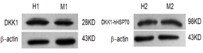 Identification of DKK1 by Western blot.