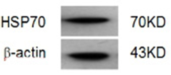 Identification of HSP70 by Western blot.