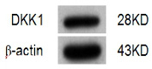 Identification of DKK1 in NS-1 myeloma cells by Western blot.