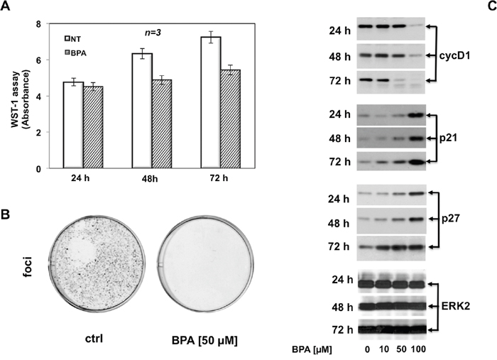 BPA halts cell cycle in LNCaP cells.