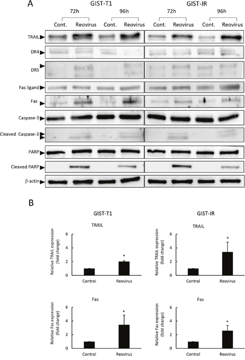 Reovirus enhanced TRAIL and Fas expression in GIST-T1 and GIST-IR cells.