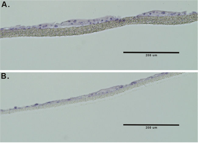 TDCM histology.