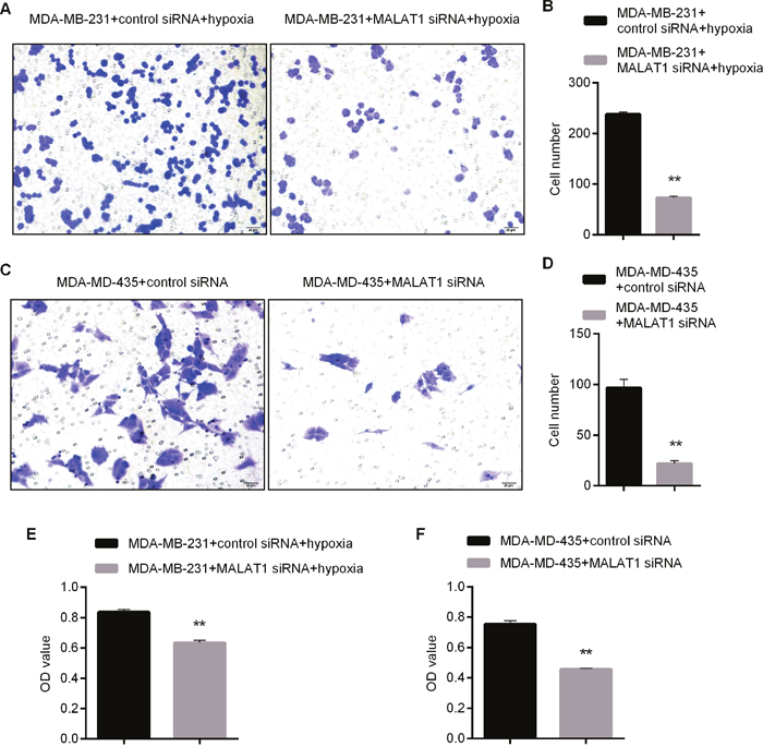 Impacts of MALAT1 Knockdown upon Proliferation and Invasion Abilities of MDA-MB-231 and MDA-MD-435.