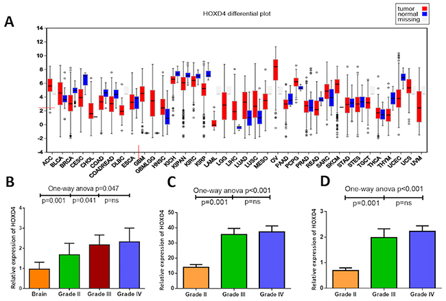 Abnormal expression of HOXD4 in diffuse glioma at mRNA level.