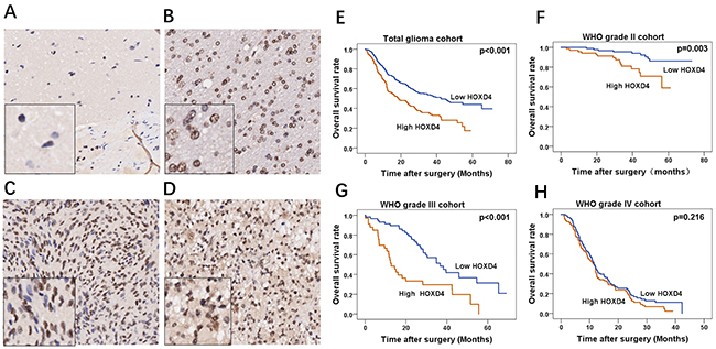 Immunohistochemical staining of HOXD4 in glioma and survival analysis of 453 patients by Kaplan-Meier method.