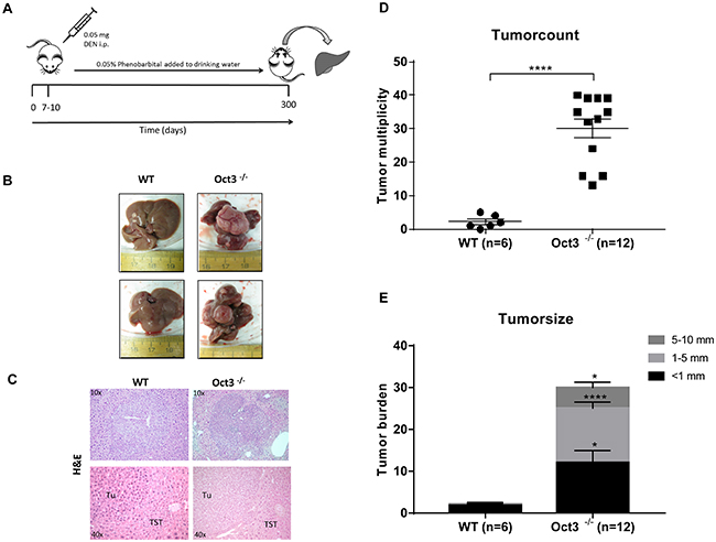 Liver tumor development.