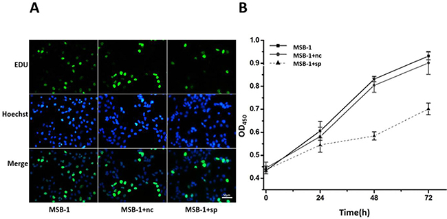 Effect of expression of MDV-1 miRNA sponge on proliferation of MSB-1 cells.
