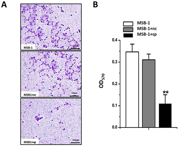 Effect of expression of MDV-1 miRNA sponge on invasion ability of MSB-1 cells.