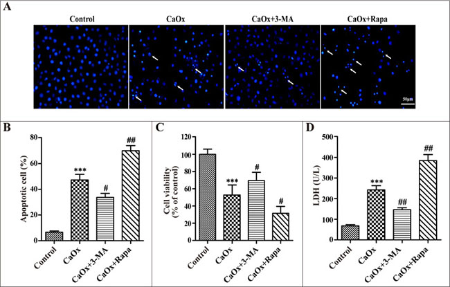 Effects of 3-methyladenine and rapamycin on CaOx crystal-induced HK-2 cell injury.