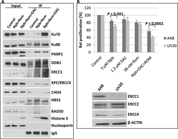 Immunoprecipitation of acetylated proteins and drug sensitivity of ERCC1-deficient cells.