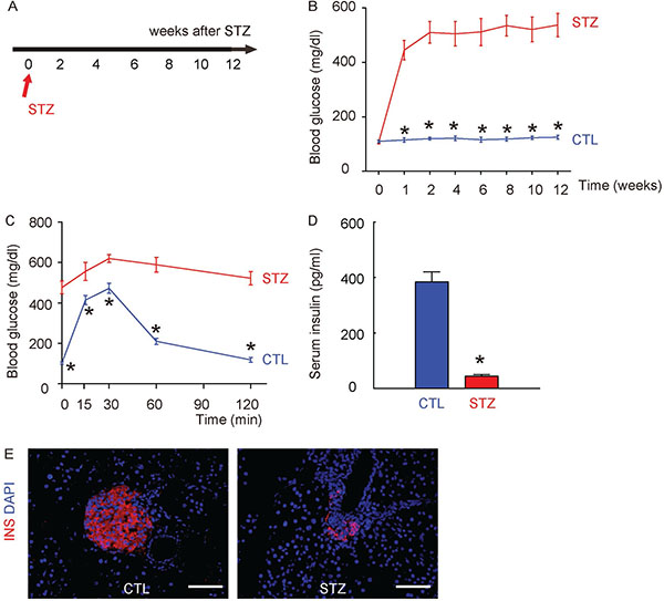 Induction of diabetes in mice by STZ administration.